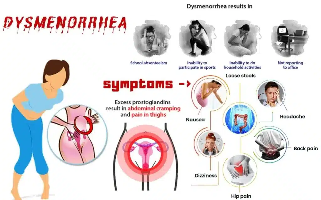 dysmenorrhoea